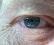 old lady's eye